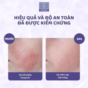 Sữa tắm gội hữu cơ Jonzac 250ml chính hãng tại Chip Chip Luxury Nha Trang